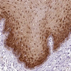 Immunohistochemical staining of human Esophagus shows strong nuclear and cytoplasmic positivity in squamous epithelial cells.