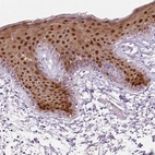 Immunohistochemical staining of human Skin shows strong nuclear and cytoplasmic positivity in squamous epithelial cells.