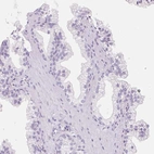Immunohistochemical staining of human Prostate shows no positivity in glandular cells as expected.