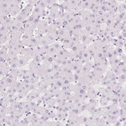 Immunohistochemical staining of human Liver shows no positivity in hepatocytes as expected.