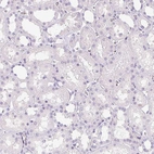 Immunohistochemical staining of human Kidney shows no positivity in cells in tubules as expected.