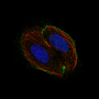 Anti-CSF1R Antibody