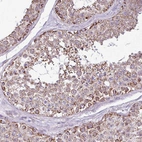 Immunohistochemical staining of human testis shows moderate granular cytoplasmic positivity in cells in seminiferous ducts.