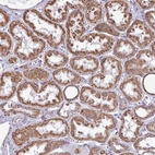 Immunohistochemical staining of human kidney shows moderate granular cytoplasmic positivity in cells in tubules.