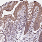 Immunohistochemical staining of human colon shows moderate granular cytoplasmic positivity in glandular cells.