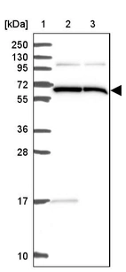 Lane 1: Marker [kDa] 250, 130, 95, 72, 55, 36, 28, 17, 10_br/_Lane 2: Human cell line RT-4_br/_Lane 3: Human cell line U-251MG sp
