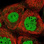 Immunofluorescent staining of human cell line A-431 shows localization to nucleoplasm.