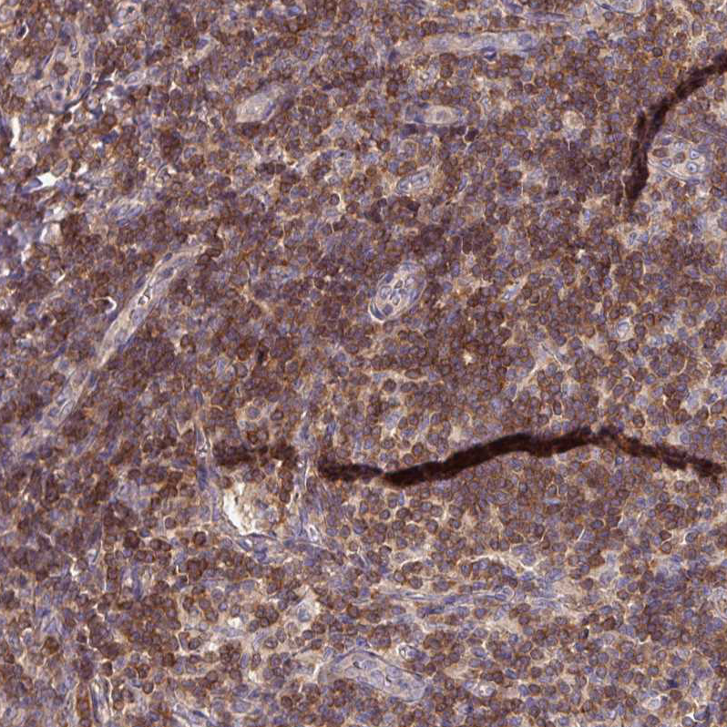 Anti-SLAMF6 Antibody