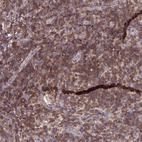 Anti-SLAMF6 Antibody
