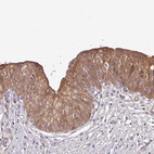 Immunohistochemical staining of human urinary bladder shows moderate membranous positivity in urothelial cells.