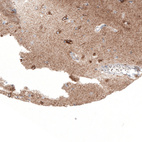 Immunohistochemical staining of human cerebral cortex shows strong granular cytoplasmic positivity in neuronal cells.
