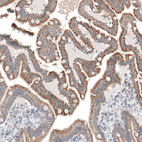 Immunohistochemical staining of human duodenum shows moderate tgranular cytoplasmic positivity in glandular cells.