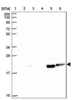 Lane 1: Marker [kDa] 250, 130, 95, 72, 55, 36, 28, 17, 10_br/_Lane 2: Human cell line RT-4_br/_Lane 3: Human cell line U-251MG sp_br/_Lane 4: Human plasma (IgG/HSA depleted)_br/_Lane 5: Human liver tissue_br/_Lane 6: Human tonsil tissue