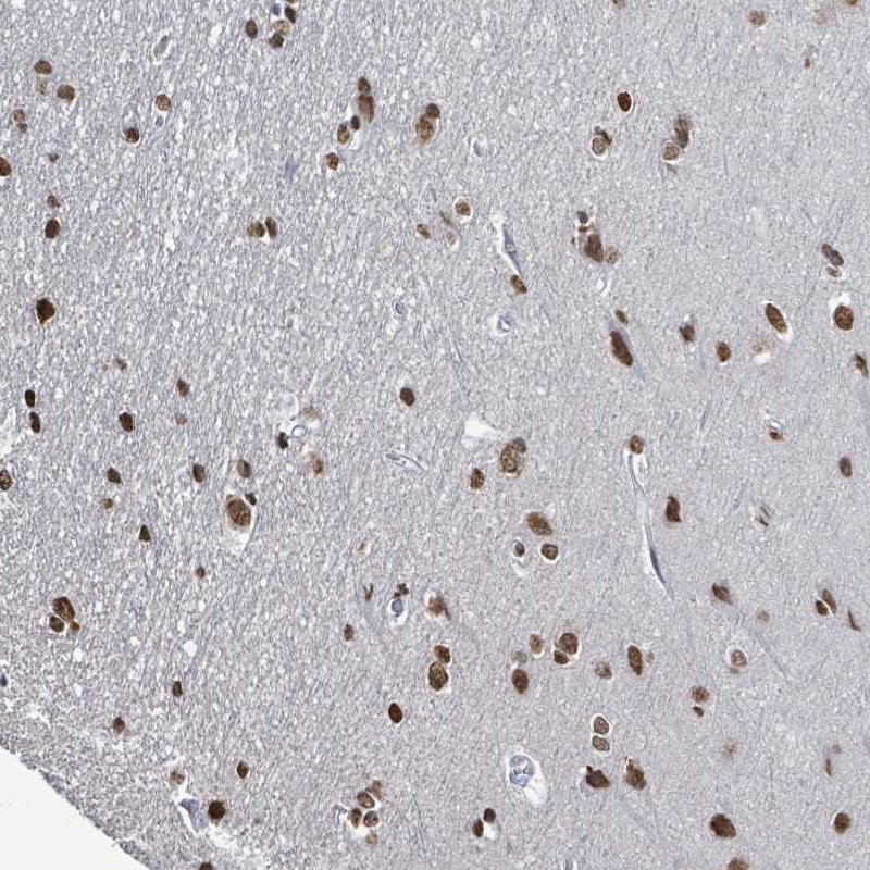 Anti-SAMD14 Antibody