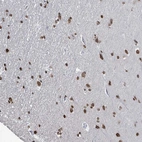 Anti-SAMD14 Antibody