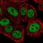 Immunofluorescent staining of human cell line MCF7 shows localization to nucleoplasm & nuclear bodies.
