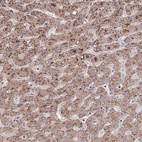 Anti-LSM12 Antibody