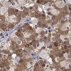 Anti-CCDC66 Antibody