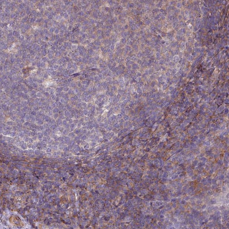 Anti-LRRC41 Antibody