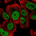 Immunofluorescent staining of human cell line PC-3 shows localization to nucleoplasm & nuclear bodies.