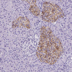Anti-SLC7A8 Antibody
