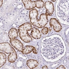 Immunohistochemical staining of human kidney shows moderate to strong cytoplasmic positivity in cells in tubules.
