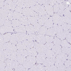 Immunohistochemical staining of human skeletal muscle shows no positivity in myocytes as expected.