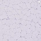 Immunohistochemical staining of human skeletal muscle shows no positivity in myocytes as expected.
