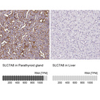 Immunohistochemistry analysis in human parathyroid gland and liver tissues using HPA051950 antibody. Corresponding SLC7A8 RNA-seq data are presented for the same tissues.
