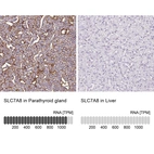 Immunohistochemistry analysis in human parathyroid gland and liver tissues using HPA051950 antibody. Corresponding SLC7A8 RNA-seq data are presented for the same tissues.