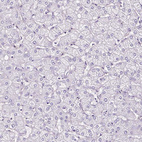 Anti-SLC7A8 Antibody