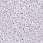 Immunohistochemical staining of human liver shows no positivity in hepatocytes as expected.