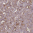 Immunohistochemical staining of human parathyroid gland shows strong membranous staining in glandular cells.