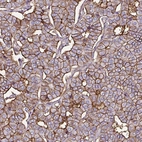 Immunohistochemical staining of human parathyroid gland shows strong membranous staining in glandular cells.