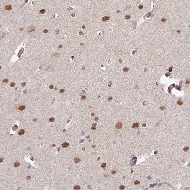 Anti-SKIV2L Antibody