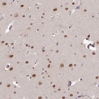 Anti-SKIV2L Antibody
