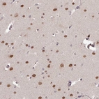 Anti-SKIV2L Antibody