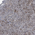Anti-COL20A1 Antibody