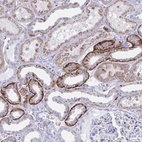 Anti-PLEKHH1 Antibody