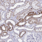 Anti-PLEKHH1 Antibody