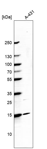 Anti-CCDC58 Antibody