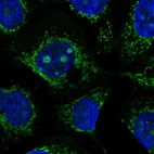 Immunofluorescent staining of human cell line MCF7 shows localization to nucleoli & mitochondria.