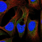 Immunofluorescent staining of human cell line U-2 OS shows localization to peroxisomes.