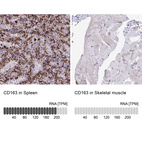 Anti-CD163 Antibody