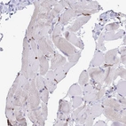 Immunohistochemical staining of human skeletal muscle shows low positivity as expected.