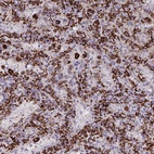 Anti-CD163 Antibody