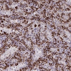 Immunohistochemical staining of human spleen shows strong membranous positivity in cells in red pulp.