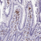 Immunohistochemical staining of human duodenum shows strong membranous positivity in lymphoid cells.