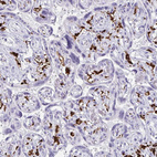 Anti-CD163 Antibody