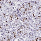 Immunohistochemical staining of human placenta shows strong membranous positivity in lymphoid cells.